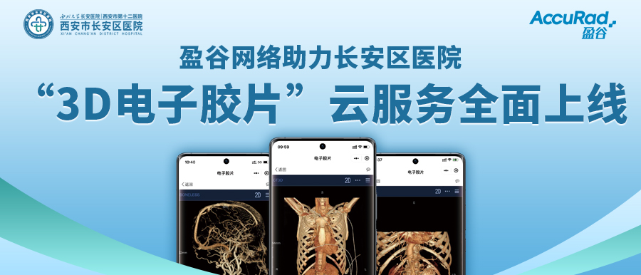 盈谷網(wǎng)絡(luò )助力長(cháng)安區醫院“3D電子膠片”云服務(wù)全面上線(xiàn)！診斷結果、影像資料隨時(shí)隨地看！